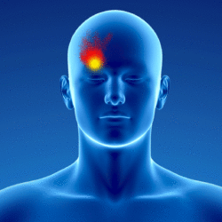 Síndrome miofascial occipitofrontal