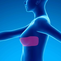 Cicatricial neuropathic pain of operated breast cancer