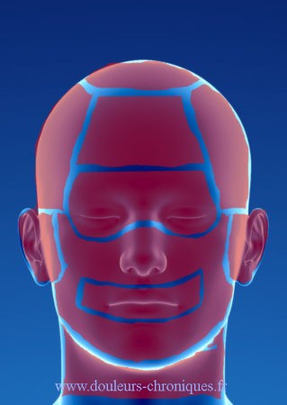 Head and neck pain
