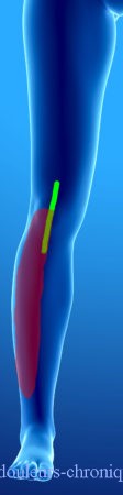 Cirugía de rodilla (prótesis, artroscopia, etc.). Topografía posible del dolor neuropático según abordajes