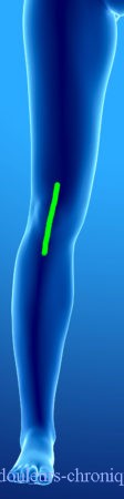 Abordaje de cirugía de rodilla (prótesis, artroscopia, etc.).